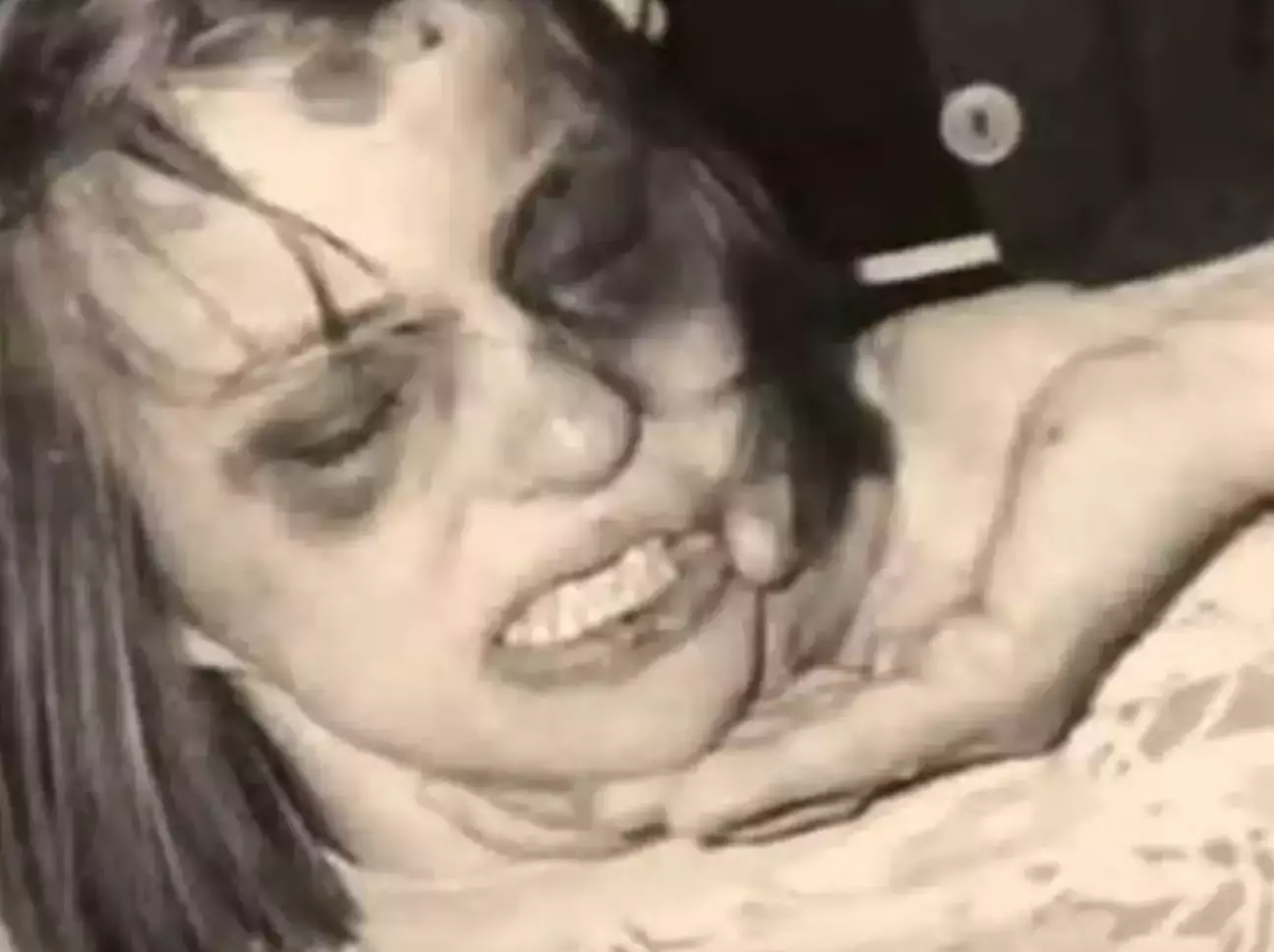 A história real da jovem 'possuída' que inspirou filme de exorcismo é mais trágica que o filme