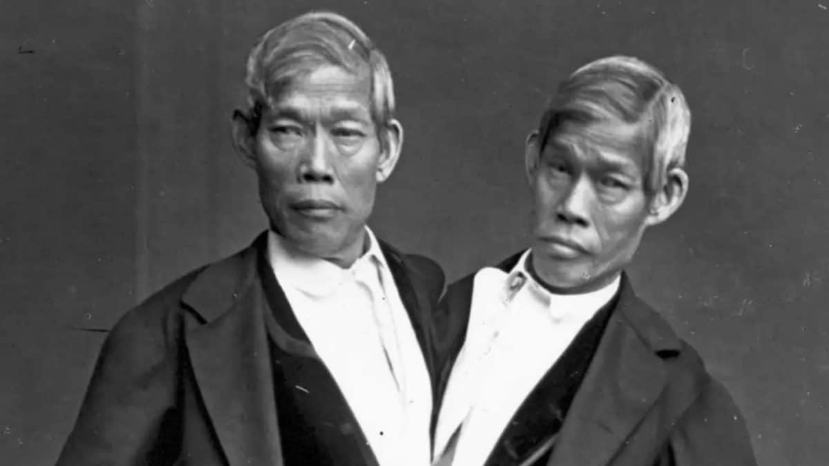 Chang e Eng Bunker, os gêmeos siameses que tiveram 21 filhos
