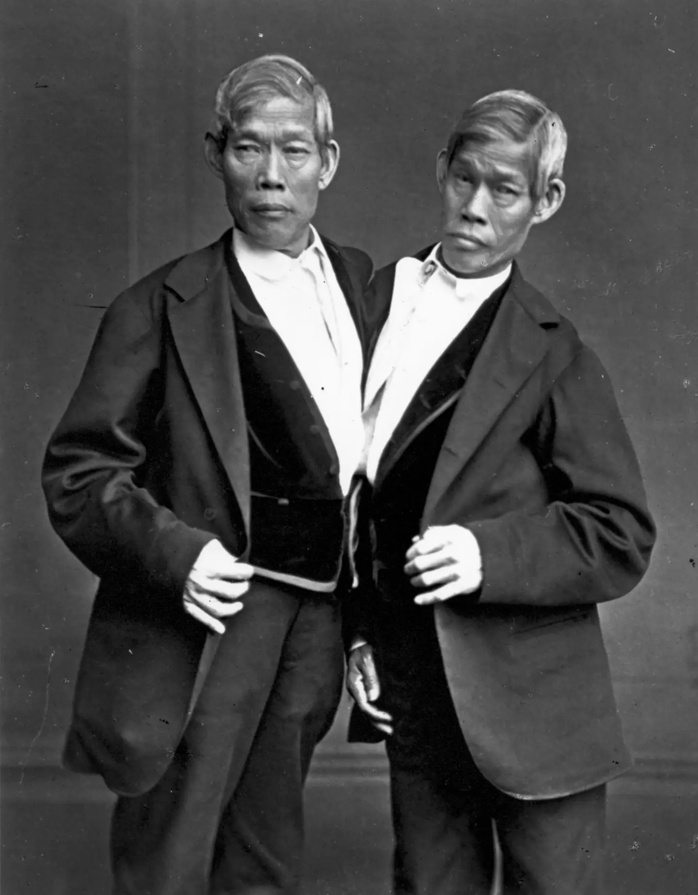 Gêmeos siameses mundialmente famosos tiveram 21 filhos durante sua vida