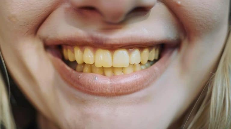 Escovar os dentes antes ou depois do café da manhã?