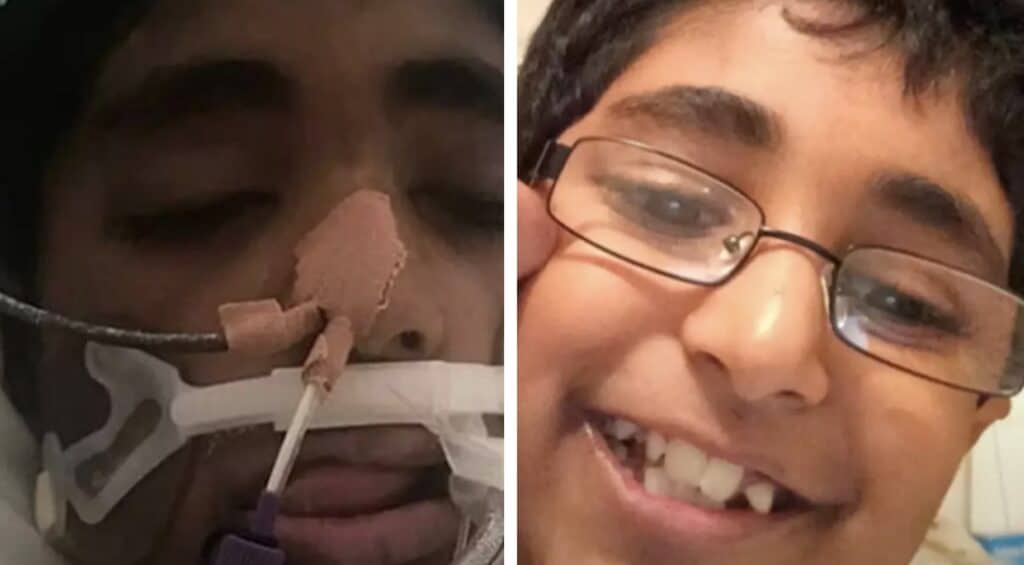 Menino de 13 anos com alergia grave morreu após ter um pedaço de queijo atirado nele por um colega