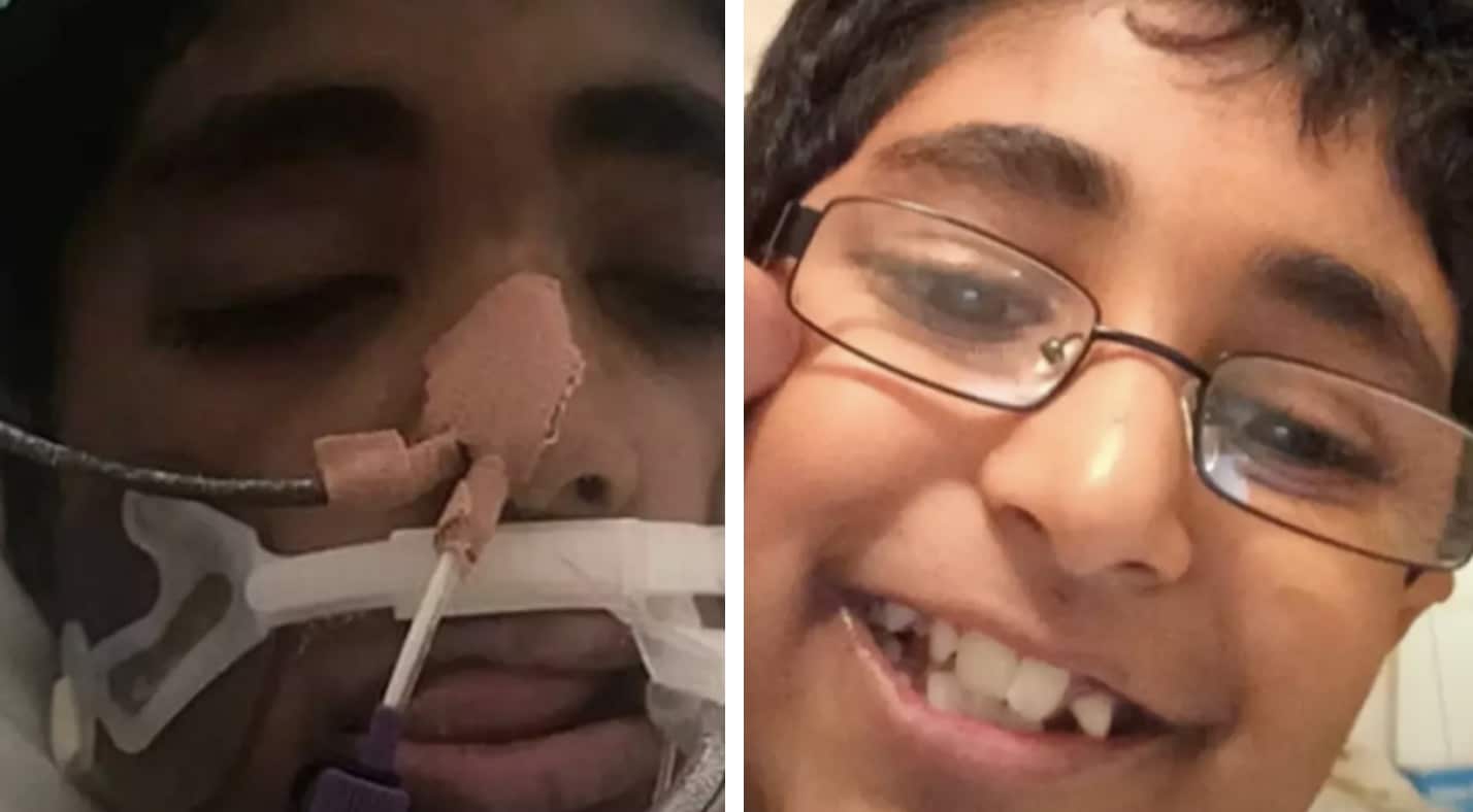 Menino de 13 anos com alergia grave morreu após ter um pedaço de queijo atirado nele por um colega