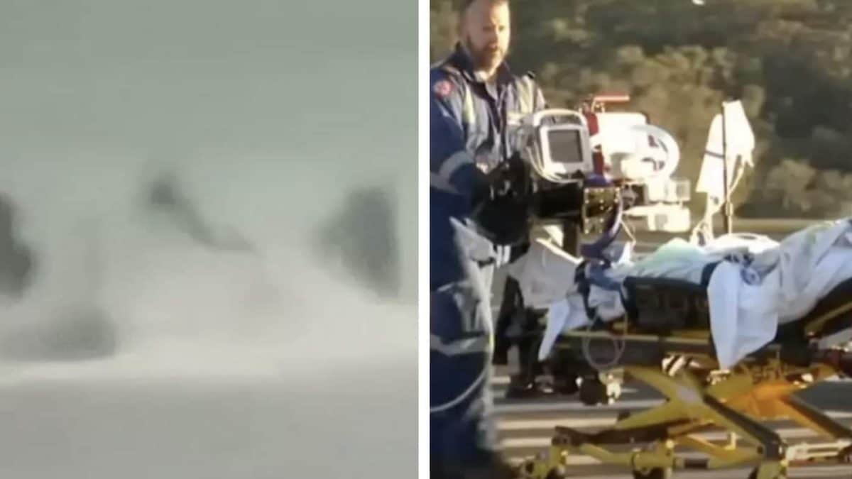 Surfista sobrevive a ataque de tubarão e perde perna