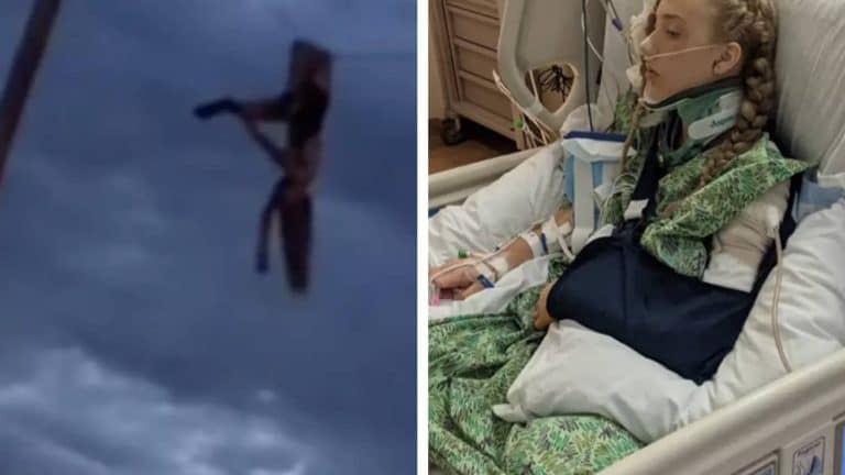 Adolescente deixada pendurada por uma perna quebrada em linha de energia após acidente horrível revela maneira terrível como sobreviveu.