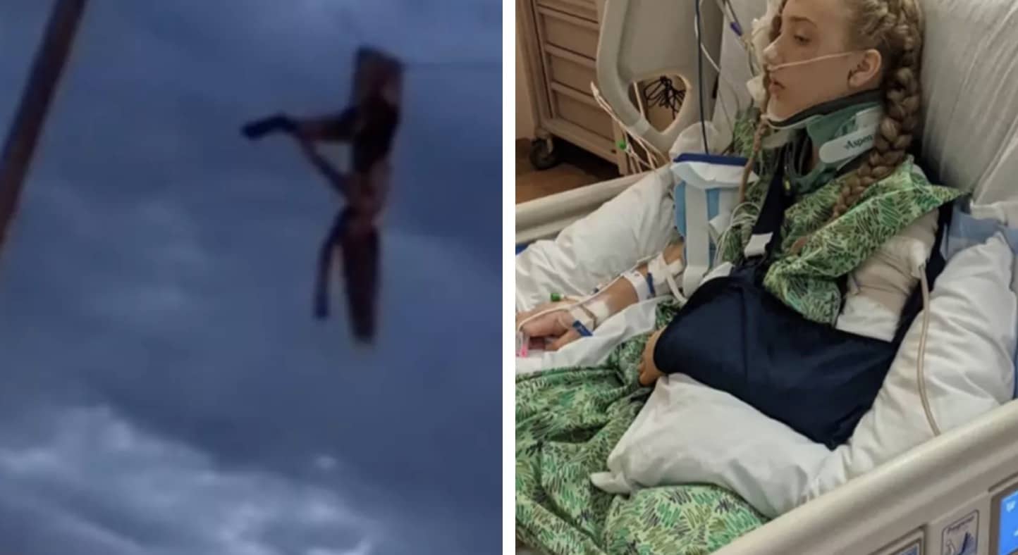 Jovem deixada pendurada por uma perna quebrada em linha de energia após acidente horrível revela maneira terrível como sobreviveu