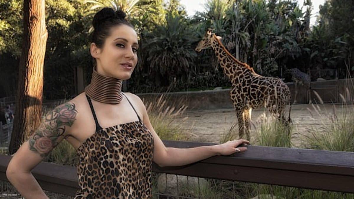 Como ficou a 'mulher-girafa', que passou 5 anos com anéis no pescoço?