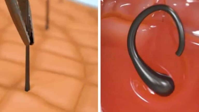Simulação assustadora mostra o que acontece quando você arranca um pelo do rosto