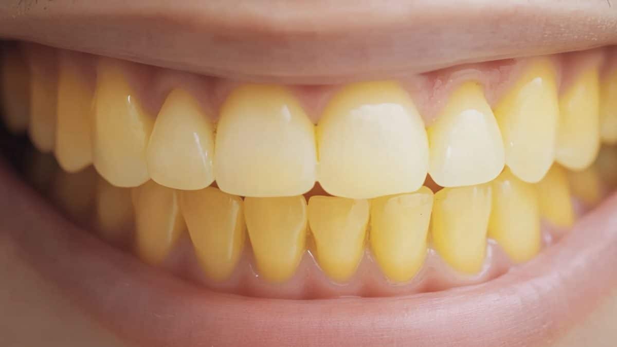 dente