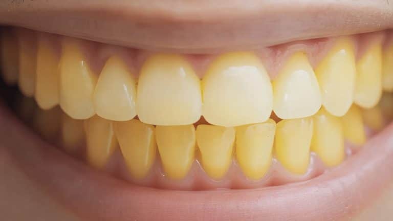 dente