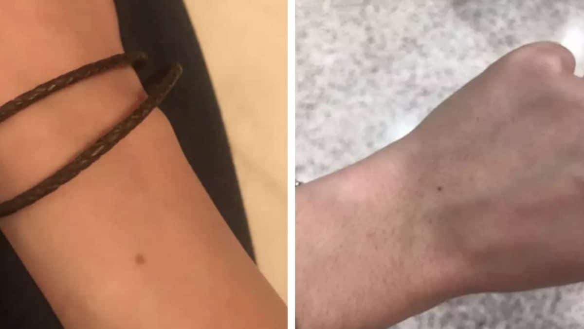 A razão pela qual tantas pessoas parecem ter a mesma pinta exata