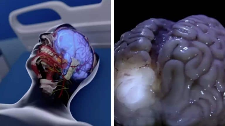 Vídeo realista mostra o que acontece com o cérebro dentro de 10 minutos após a morte