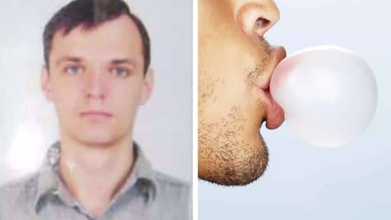 Erro fatal cometido por estudante que morreu após chiclete explodir e arrancar metade de seu rosto