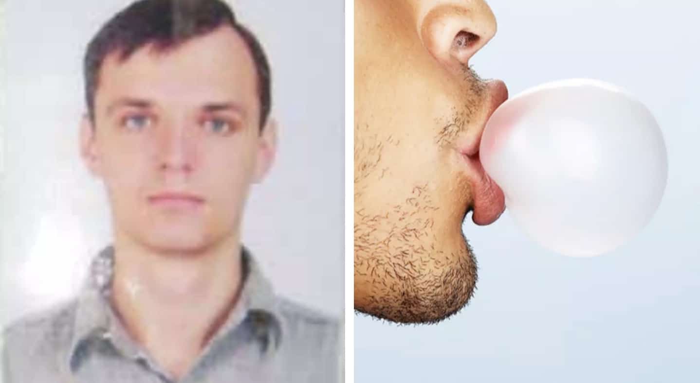 Erro fatal cometido por estudante que morreu após chiclete explodir e arrancar metade de seu rosto