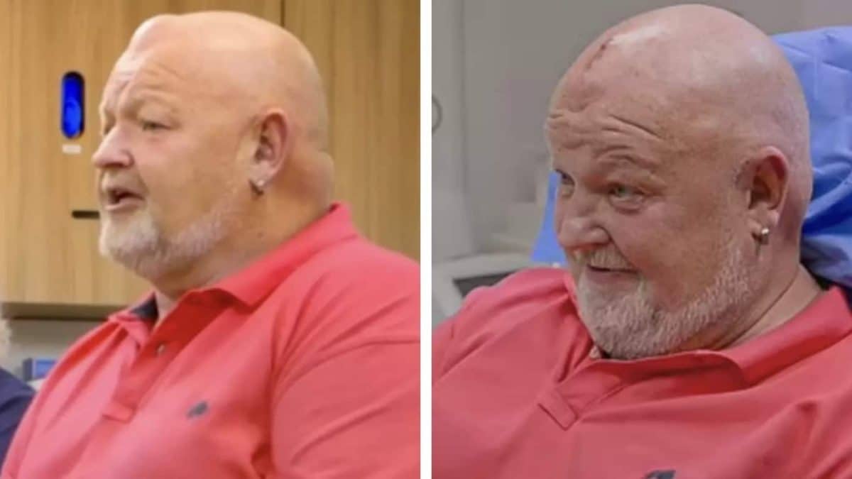 Homem que tinha caroço na cabeça há 30 anos após ser atingido por bola finalmente descobre o que é