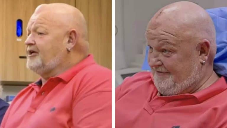 Homem que tinha caroço na cabeça há 30 anos após ser atingido por bola finalmente descobre o que é