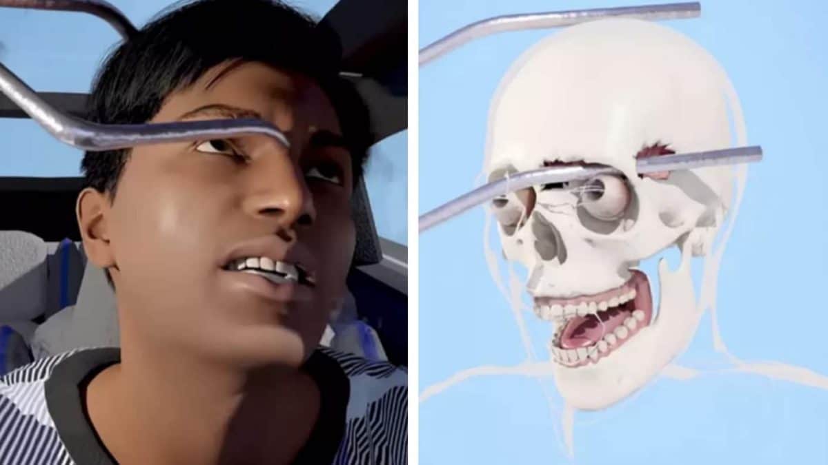 Simulação horripilante mostra como homem sobreviveu a uma barra de 90 centímetros atravessando sua cabeça durante acidente de carro