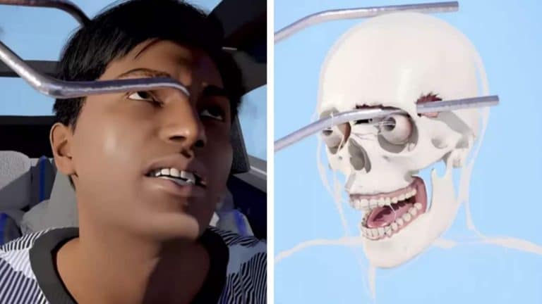 Simulação horripilante mostra como homem sobreviveu a uma barra de 90 centímetros atravessando sua cabeça durante acidente de carro
