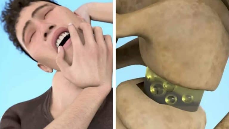 Vídeo traumatizante revela como estalar o pescoço pode matar você
