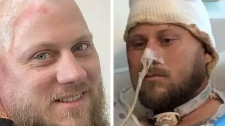 Homem que foi eletrocutado por 4.160 volts assistiu horrivelmente à sua 'pele derreter'