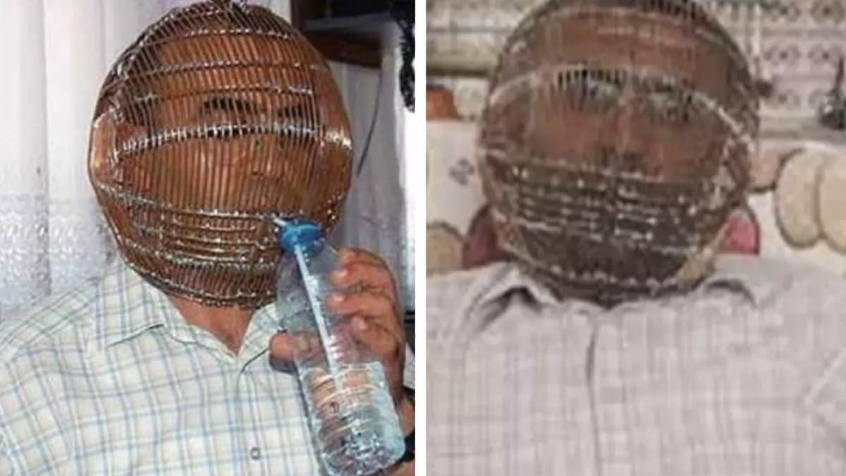 Homem que queria parar de fumar prendeu sua cabeça em uma gaiola e deu a chave apenas para sua esposa