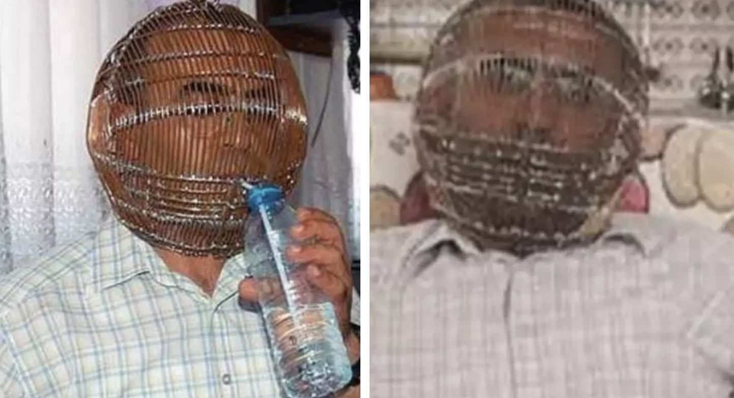 Homem que queria parar de fumar prendeu sua cabeça em uma gaiola e deu a chave apenas para sua esposa