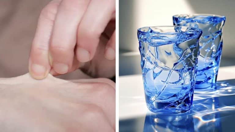 Médico revela um simples "teste do beliscão" que pode indicar se você está desidratado em segundos