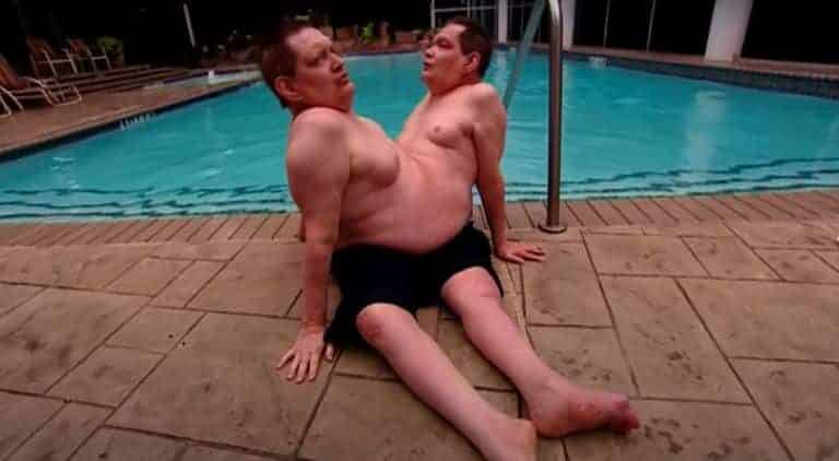 Os gêmeos siameses mais velhos de todos os tempos deram uma resposta incrível quando perguntados se teriam desejado ser separados