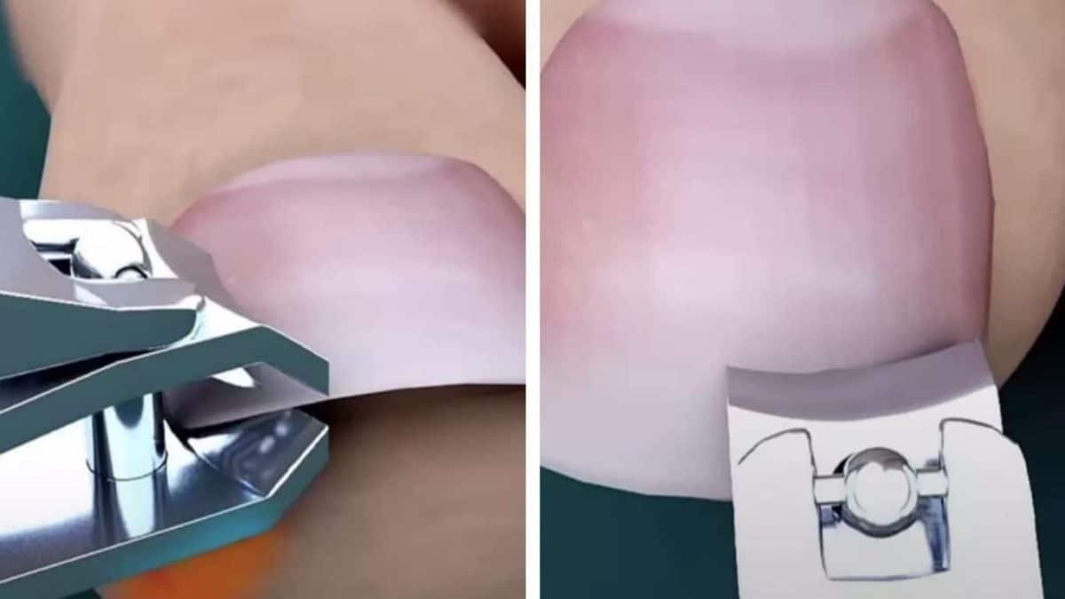 As pessoas estão descobrindo que estão cortando as unhas dos pés de forma errada após verem uma simulação bizarra