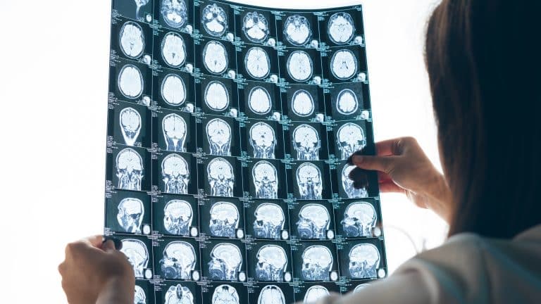 Cientistas gravam cérebro humano durante a morte e fazem uma revelação incrível