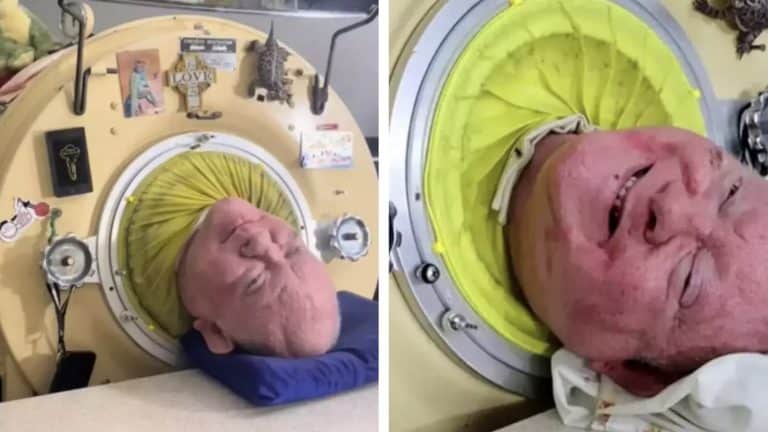Como homem sobreviveu dentro de um "pulmão de ferro" por 70 anos antes de falecer no ano passado