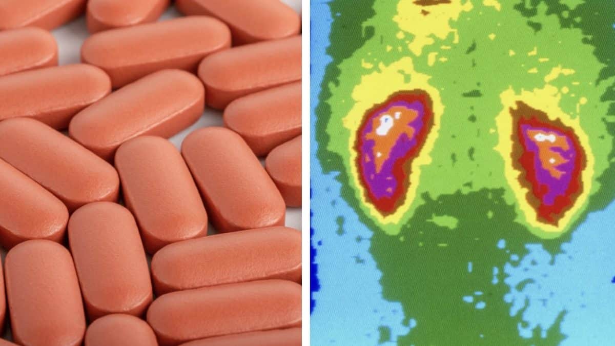 Consequências graves que um homem sofreu após tomar 1.176 comprimidos de ibuprofeno em um mês