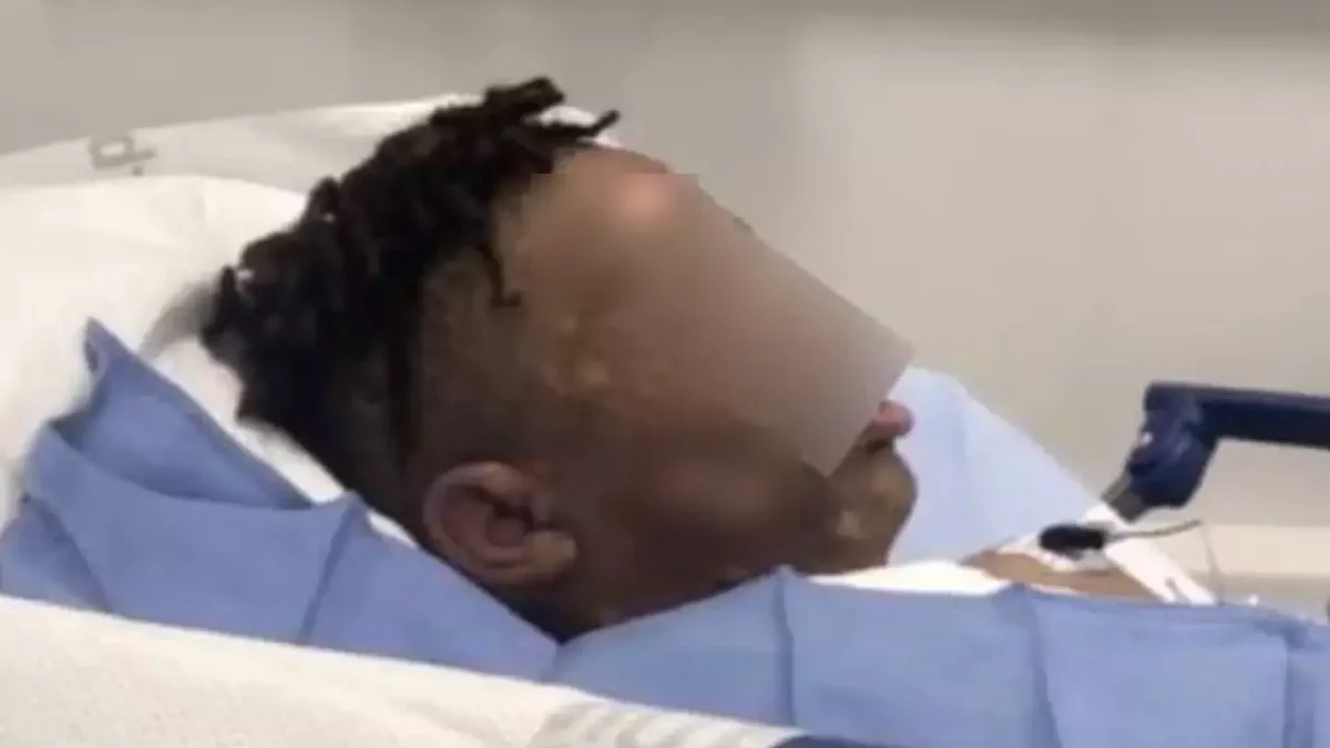 Garotos enfrentam acusações após 'jogarem água fervente em amigo' durante brincadeira em festa do pijama