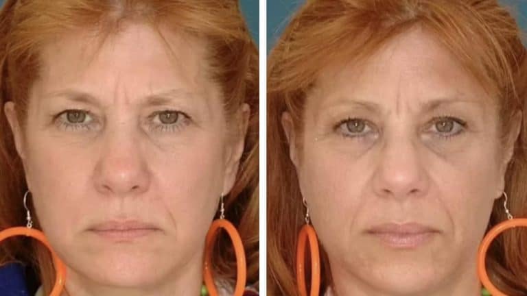 Gêmeas idênticas revelam diferença chocante na aparência após uma se divorciar e a outra permanecer casada