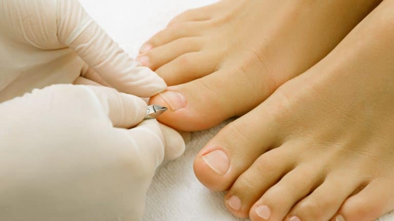 Médicos alertam sobre sintoma pouco conhecido de câncer que pode ser visto nas unhas dos pés