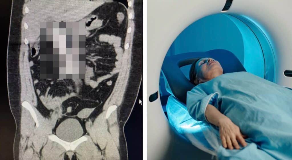 Mulher fica "gritando" de dor após entrar com "brinquedo" em exame de ressonância magnética, enquanto alertas são emitidos