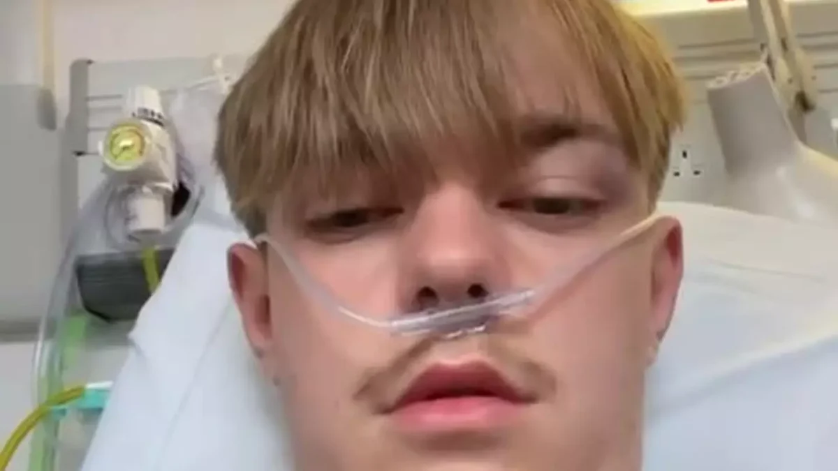 Jovem que usava vape equivalente a 50 cigarros por dia recebe diagnóstico "chocante" após tossir "litros" de sangue