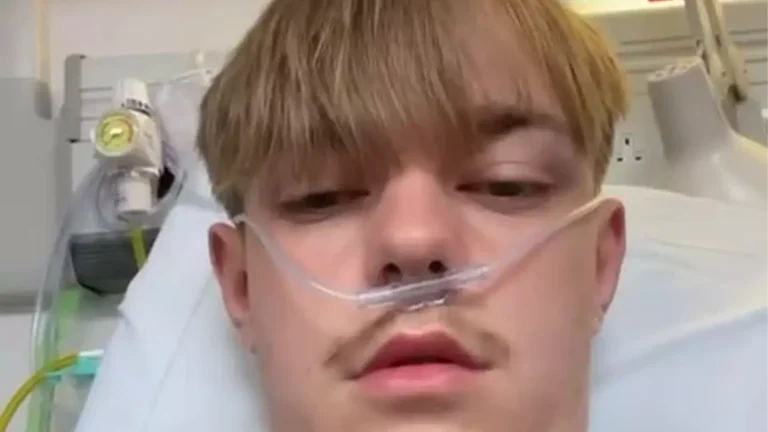 Jovem que usava vape equivalente a 50 cigarros por dia recebe diagnóstico "chocante" após tossir "litros" de sangue