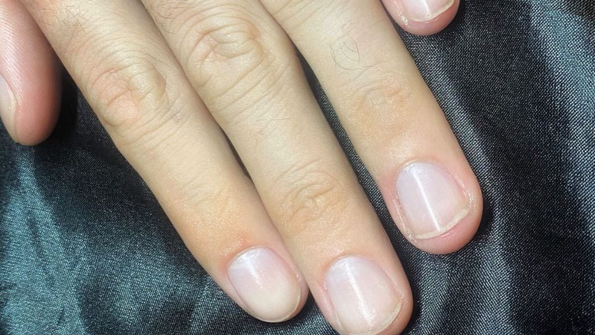 Especialista de Harvard revela que é possível prever sua expectativa de vida observando o estado de suas unhas
