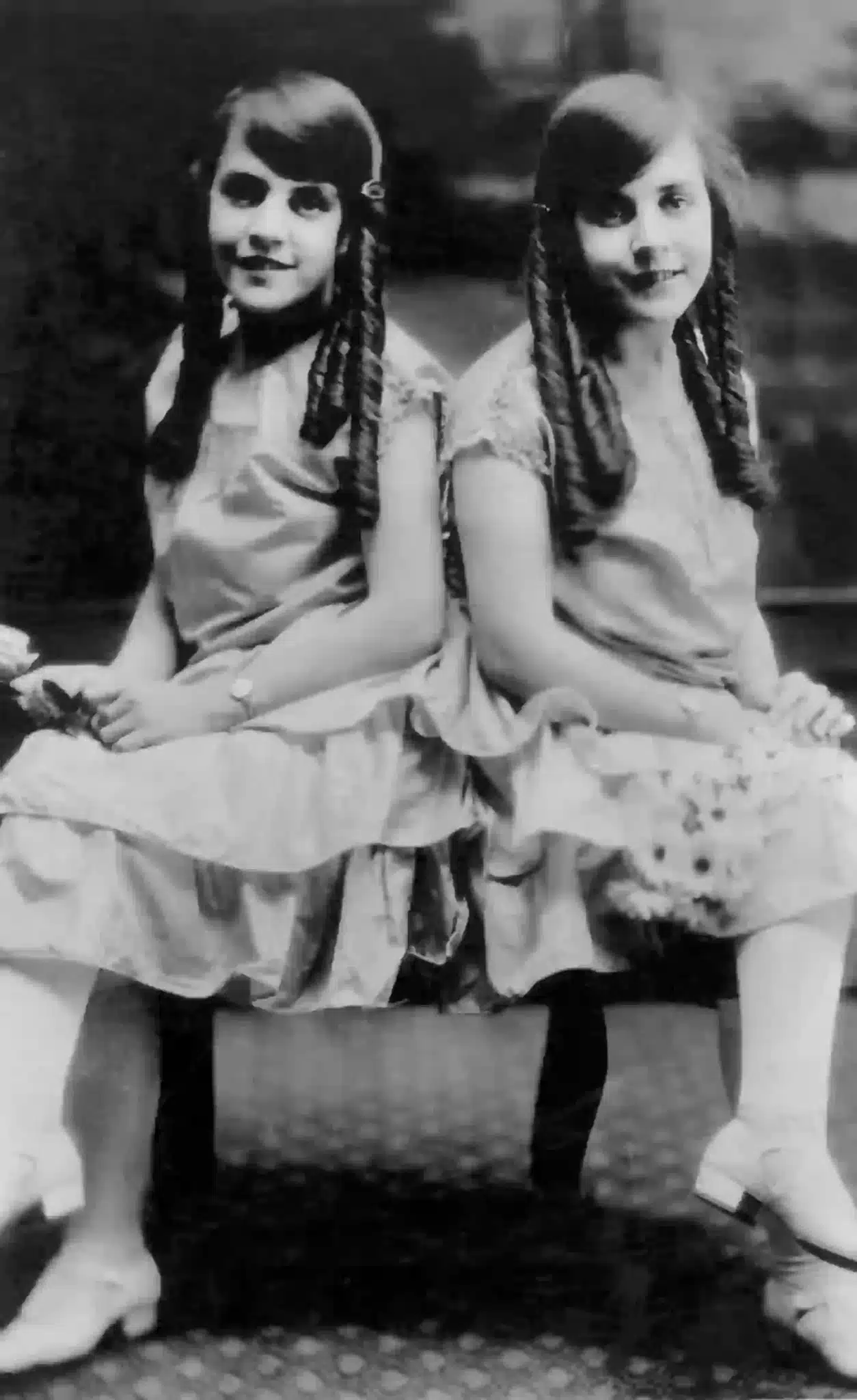 Gêmeas siamesas, Daisy e Violet Hilton