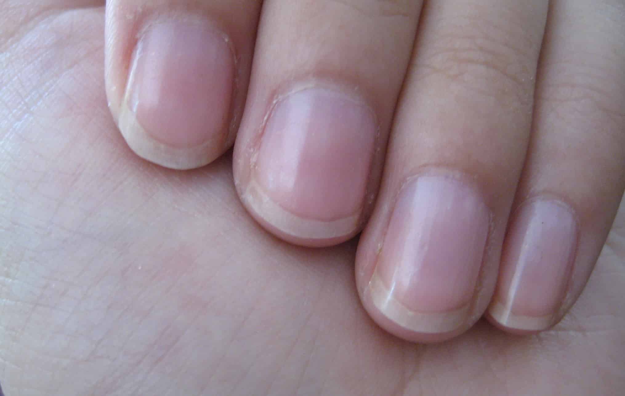 O que o crescimento das suas unhas revela sobre sua verdadeira idade biológica?