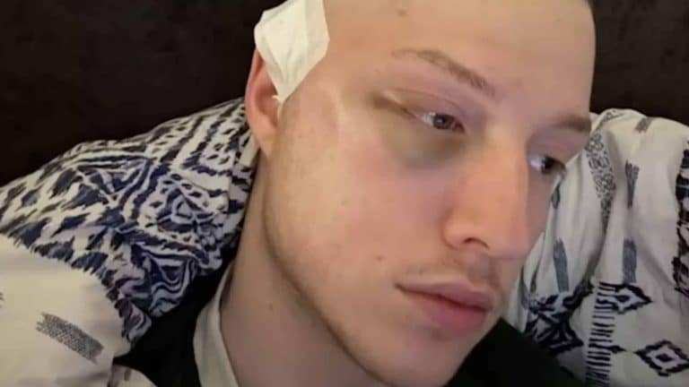 Homem foi diagnosticado com câncer no cérebro após médicos dizerem que o principal sintoma era ansiedade