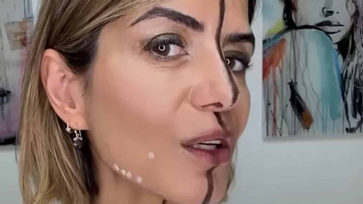 Mulher injeta apenas um lado do rosto para mostrar as diferenças que o Botox faz