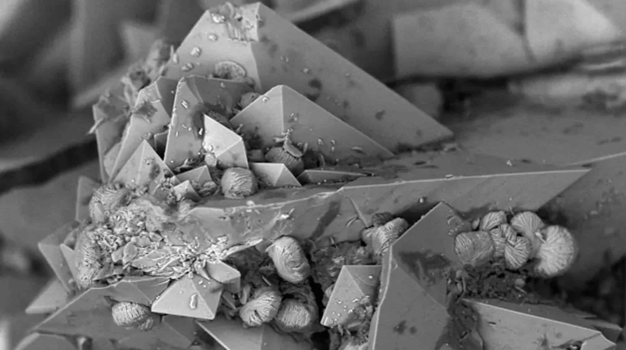 Pessoas ficam horrorizadas ao descobrir como é a pior dor humana vista no microscópio Pessoas ficam horrorizadas ao descobrir como é a pior dor humana vista no microscópio