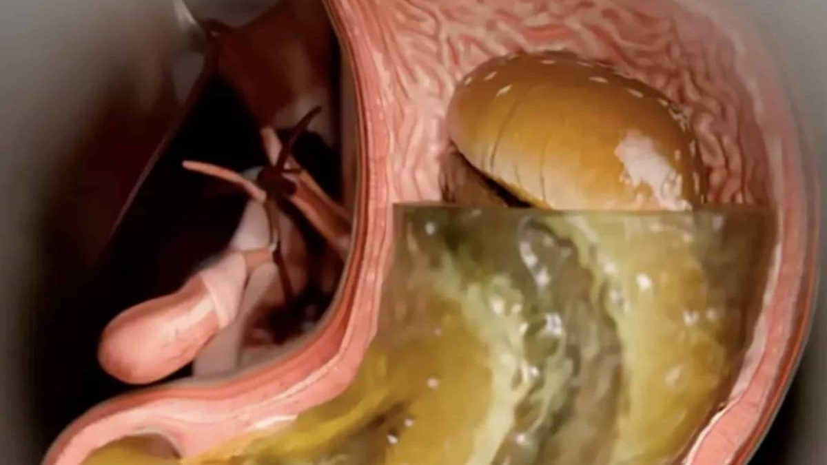 Simulação mostra realidade sombria do que o Ozempic realmente faz ao seu corpo após a injeção