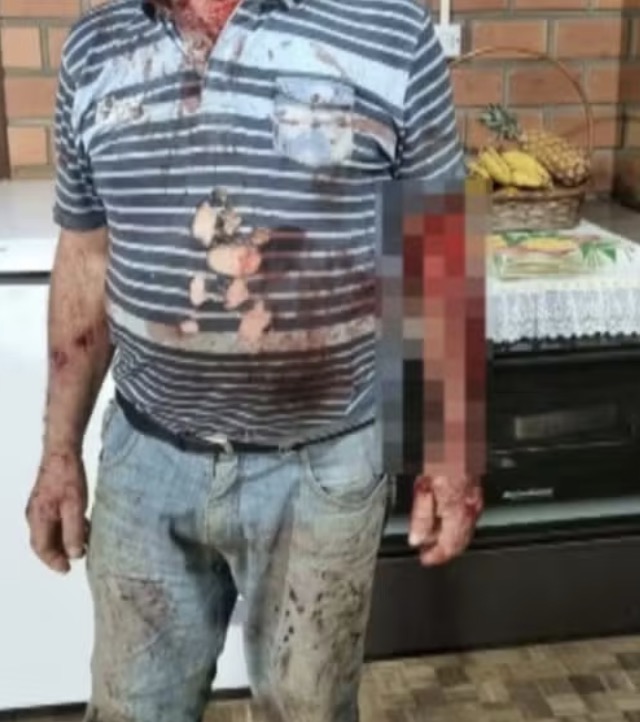 Homem é atacado por onça-parda no RS Agricultor sofreu ferimentos