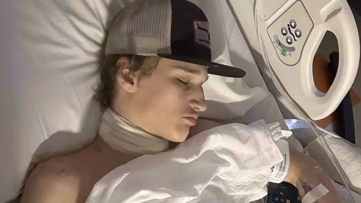 Alerta de mãe após adolescente quase morrer em acidente bizarro com carregador de celular que deixou o pescoço todo cheio de cicatrizes