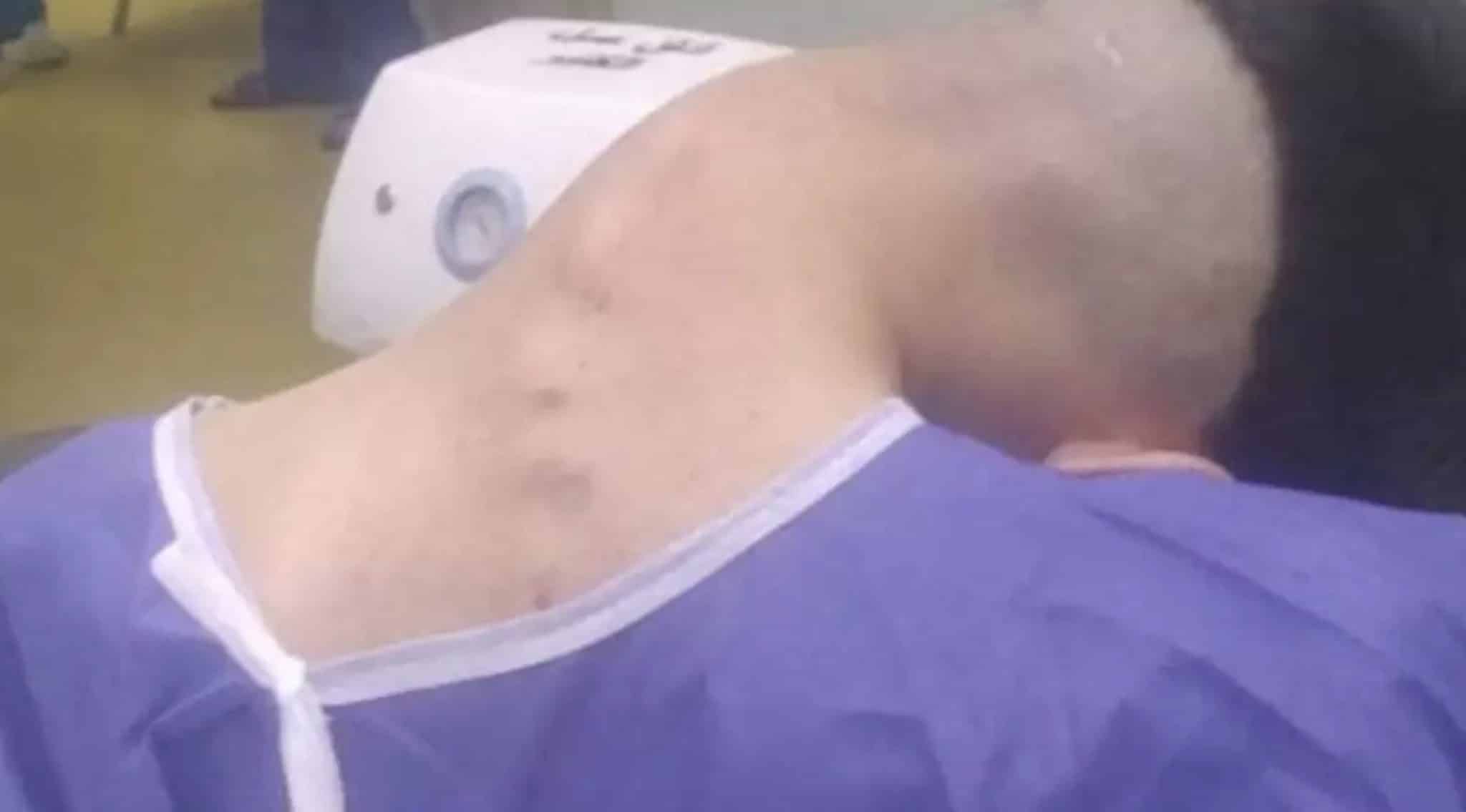 Homem de 23 anos desenvolve rara condição chamada 'síndrome da cabeça caída' após anos lutando contra vício Homem de 23 anos desenvolve rara condição chamada 'síndrome da cabeça caída' após anos lutando contra vício