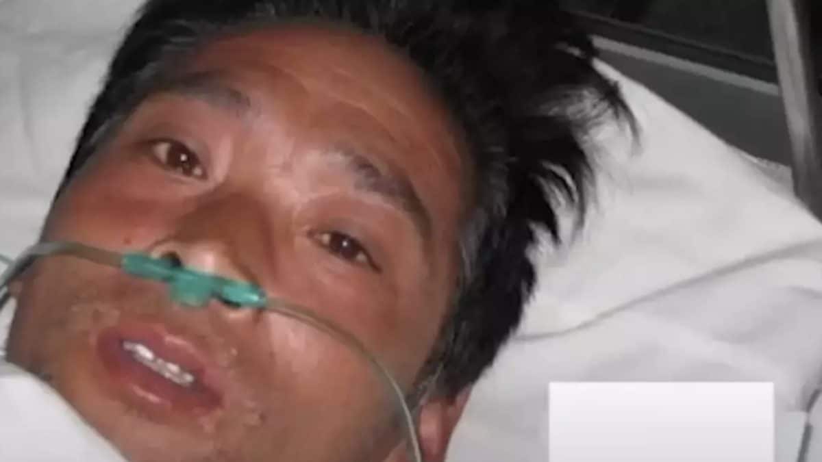 Incidente horrífico fez homem sofrer 'a morte mais dolorosa da história', chorando sangue e sendo mantido vivo por 83 dias