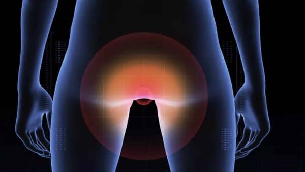 Novo estudo sugere que o câncer anal está em ascensão e revela quem está mais em risco