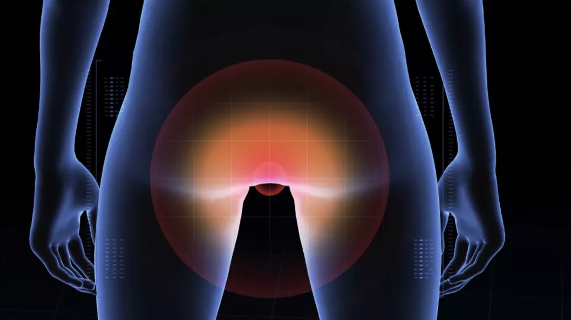 Novo estudo sugere que o câncer anal está em ascensão e revela quem está mais em risco Novo estudo sugere que o câncer anal está em ascensão e revela quem está mais em risco